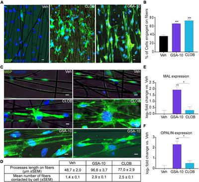 Smoothened/AMP-Activated Protein Kinase Signaling in Oligodendroglial Cell Maturation